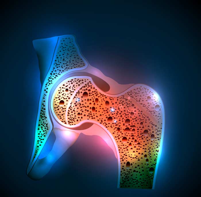 Osteoprosiship